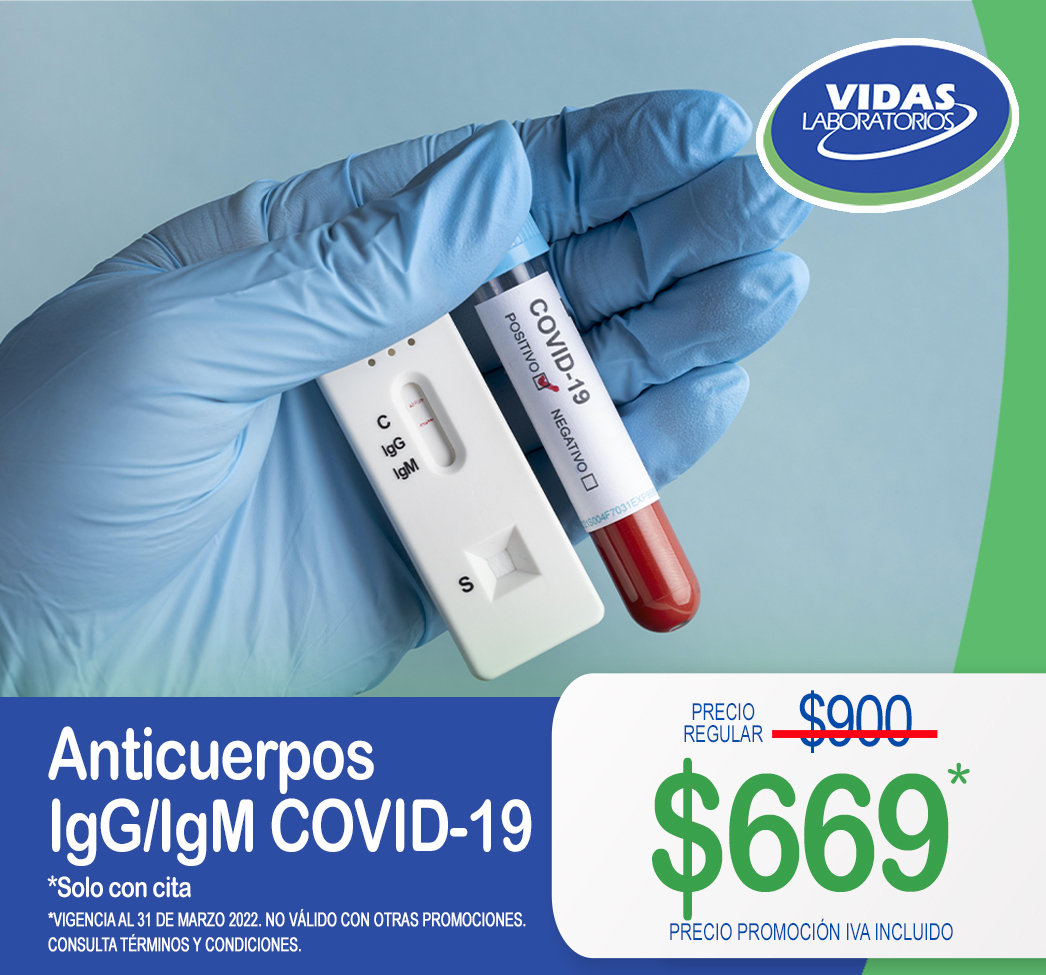 AC ANTI TOXOCARA CANIS IGG Vidas Laboratorios